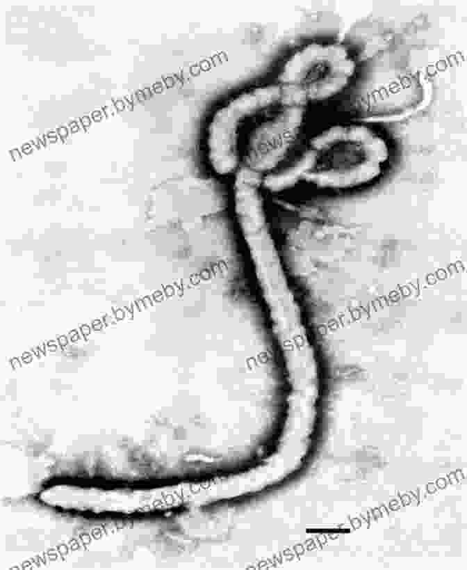 An Electron Microscope Image Of The Ebola Virus, Revealing Its Intricate And Deadly Structure. The Hot Zone: The Terrifying True Story Of The Origins Of The Ebola Virus