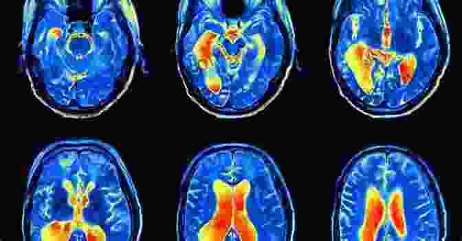 Brain Scan Showing Irrational Decision Making Sway: The Irresistible Pull Of Irrational Behavior