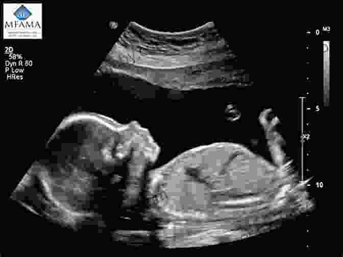 Ultrasound Image Of A Developing Baby Commando Dad: New Recruits: A Guide To Pregnancy And Birth For Dads To Be